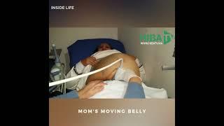 The belly of the #pregnant mom moving during the medical examination.  