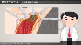 시연용 c0019aeko 유방암수술 안내유방절제술 및 겨드랑이림프절 절제술