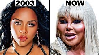 The Toxic Culture of Plastic Surgery in Hip Hop