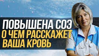 Скорость оседания эритроцитов СОЭ - о чем расскажет ваша кровь