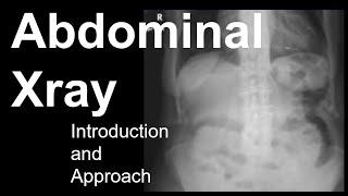 Abdominal Xray Introduction and Approach