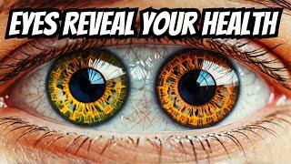 What Your Eyes Say About Your Health