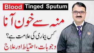Blood Tinged Sputum - Moun se khoon ana  Khoon Thukna  Causes By Dr. Tariq Ali Sheikh