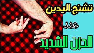 تشنج اليدين عند الصدمات النفسية، الزعل، و نوبات الهلعلا داعي لمراجعة الطوارئ carpopedal spasm