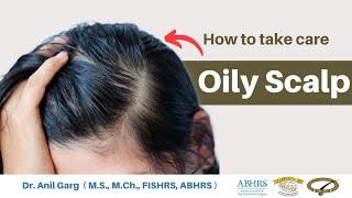 How To Treat Oily Scalp  Know Home Remedies Treatment  Greasy Scalp