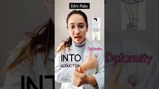 Erbs Palsy #shorts #shortsvideo #shortsviral #viral