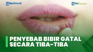 4 Kondisi Penyebab Bibir Tiba-tiba Gatal yang Ganggu Aktivitas