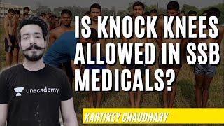 Knock Knee - Easy Treatment with Exercise for Indian Armed Forces  Kartikey Chaudhary