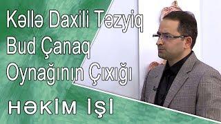 kəllə daxili təzyiq Bud çanaq oynağının çıxığı Timus vəzi nədir -  HƏKİM İŞİ  08.11.2017