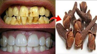 Teeth whitening in two minutes removes yellowing and tartar falls after rubbing your teeth with it a