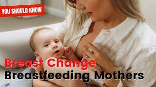 Breast Changes from Breastfeeding Mother