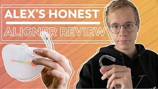 NewSmile Clear Aligners Journey  Alexs Honest Review