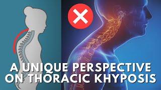 How To Fix The Root Cause Of Thoracic Kyphosis & Upper Crossed Syndrome Hunchback Posture