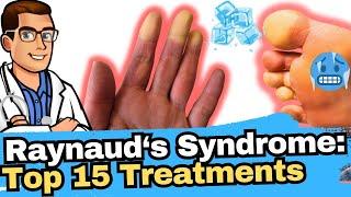 Raynauds Syndrome vs Phenomenon vs Disease? Why Are My Toes Cold?