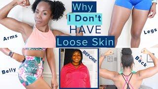 Why I Dont Have LOOSE SKIN After 100 Pound Weight Loss WITHOUT Surgery  TMI Skincare & Nutrition