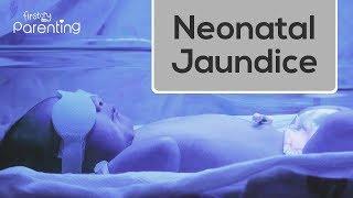 Neonatal Jaundice - Causes Symptoms and Treatment