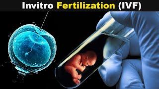 How Test Tube Babies Are produced?  Invitro Fertilization UrduHindi