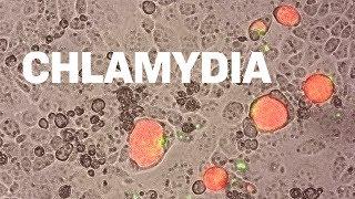 Fluorescing Parasites  Researching Chlamydia