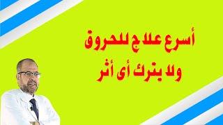 أسرع علاج للحروق  ولا يترك اى اثر على الجلد  الأمراض الجلدية والشعر  { 18 } دكتور جودة محمد عواد