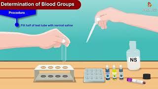 Determination of blood groups animation -  Physiology practicals