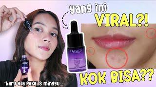 REVIEW LACOCO DARK SPOT ESSENCE  SKINCARE BEKAS JERAWAT & FLEK HITAM