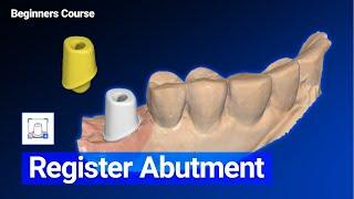 Register Abutment Custom