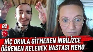 Hiç Okula Gitmeden İngilizce Öğrenen Kelebek Hastası Mehmet