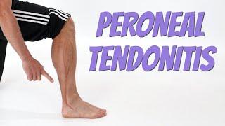 Peroneal Tendonitis Side of Foot Pain Causes & Self-Treatment.