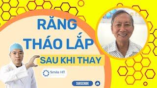 Răng Đẹp - Sau Khi Thay Răng Tháo Lắp  Nha Khoa Smile HT