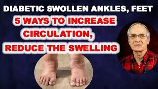 Swollen Ankles Puffy Feet - 5 Ways for Diabetics to Increase Circulation