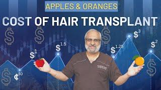 Hair Transplant Cost in India The TRUTH 