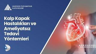 Kalp Kapak Hastalıkları ve Ameliyatsız Tedavi Yöntemleri  Prof. Dr. Ali Buturak