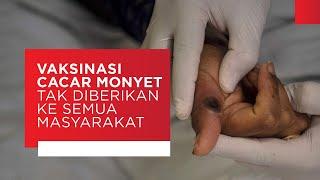Vaksinasi Cacar Monyet Tak Diberlakukan ke Semua Masyarakat