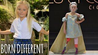 Double Amputee Slays New York & Paris Fashion Weeks  BORN DIFFERENT