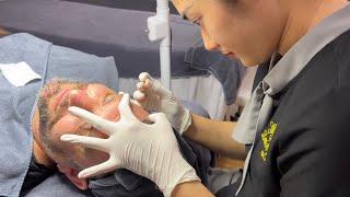 Spa Loan Nguyen  Learn Acne Treatment  Da Nang Vietnam 