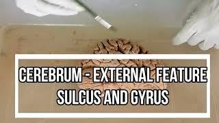 Cerebrum - External Feature  cerebrum sulci and gyri anatomy