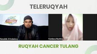 RUQYAH CANCER TULANG