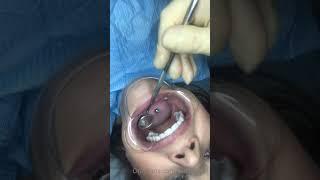 Girl at the dentist dentist checks her whole mouth