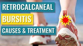 Heel Bursitis - Causes and Treatment