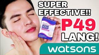 DermAid ACNE SOAP sa WATSONS Super Effective for PIMPLES