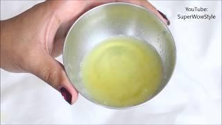 Get Rid of dandruff in 1 Day _ Instant Dandruff Remedy at Home