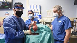 The Worlds First Pig Heart to Human Xenotransplant - University of Maryland Medicine