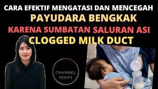 Cara Efektif Mengatasi dan Mencegah Payudara Bengkak Karena Sumbatan Saluran ASI Clogged Milk Duct