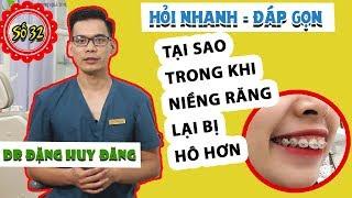 GIẢI THÍCH TẠI SAO NIỀNG RĂNG LẠI BỊ HÔ RA