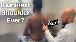 LOUDEST SHOULDER KLUNK* Chiropractic Advice For Shoulder Hypermobility & Pain Relief.