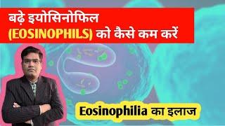 Eosinophilia का इलाज  Treatment of High Eosinophil in Blood..