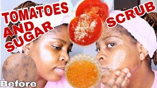 Tomatoes and sugar scrub on face  clear dark spots sunburn and blemishes. Beauty by blizzy