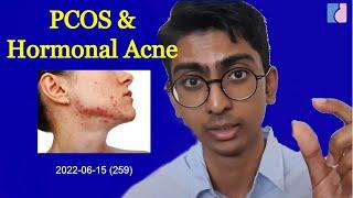 PCOS & Hormonal Acne The real cause behind your acne - Antai Hospitals