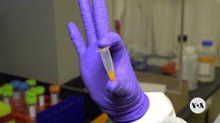 LogOn New test will be game changer in tuberculosis diagnostics  VOANews