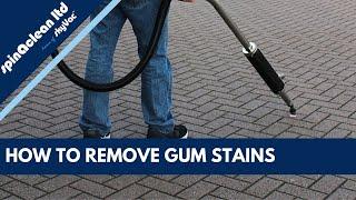 Gum Ranger Freestyle Extremely Rapid and Reliable Chewing Gum Removal System